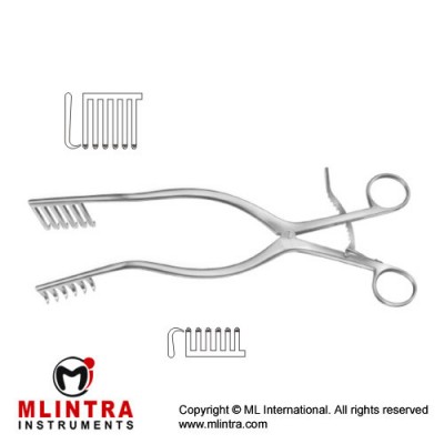 Martin Self Retaining Retractor 6 x 6 Sharp Long Prongs Teeth on Right Side Stainless Steel, 28.5 cm - 11 1/4"